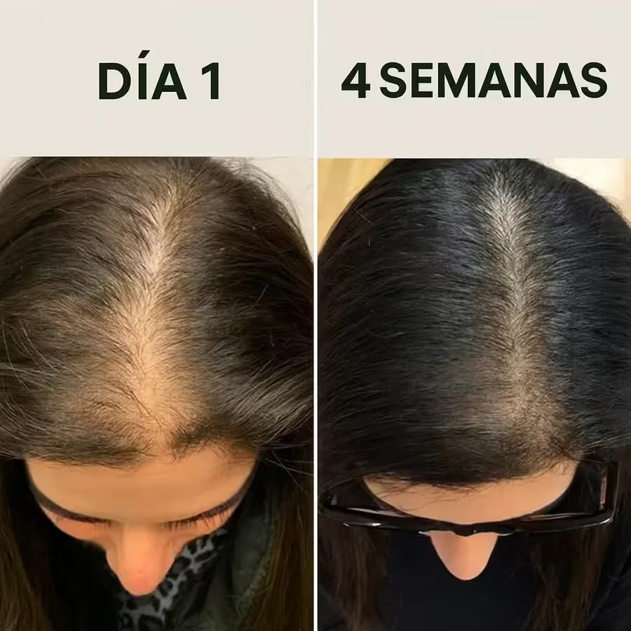 Cabello débil o con caída? Recupera la fuerza y estimula el crecimiento con el Aceite de Batana Puro
