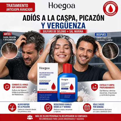 Shampoo Anticaspa Hoegoa pa