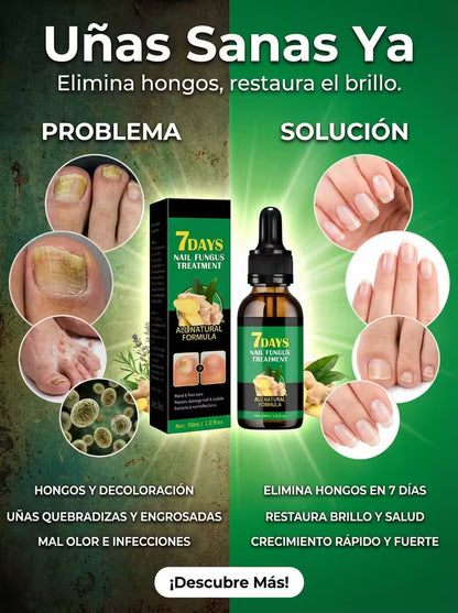 7 DAYS FUNGUS FREE NAILS® | PROTEGE Y ELIMINA EL HONGO DE TUS UÑAS