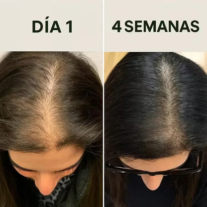 Cabello débil o con caída? Recupera la fuerza y estimula el crecimiento con el Aceite de Batana Puro